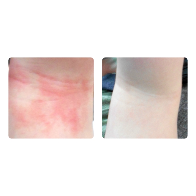 Spray nutritiv Bioskin Junior pt bebelusi si copii, piele foarte uscata cu eczeme, dermatite, Salcura 100 ml