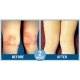 Spray nutritiv Bioskin Junior pt bebelusi si copii, piele foarte uscata cu eczeme, dermatite, Salcura 100 ml