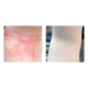 Spray nutritiv Bioskin Junior pt bebelusi si copii, piele foarte uscata cu eczeme, dermatite, Salcura 100 ml
